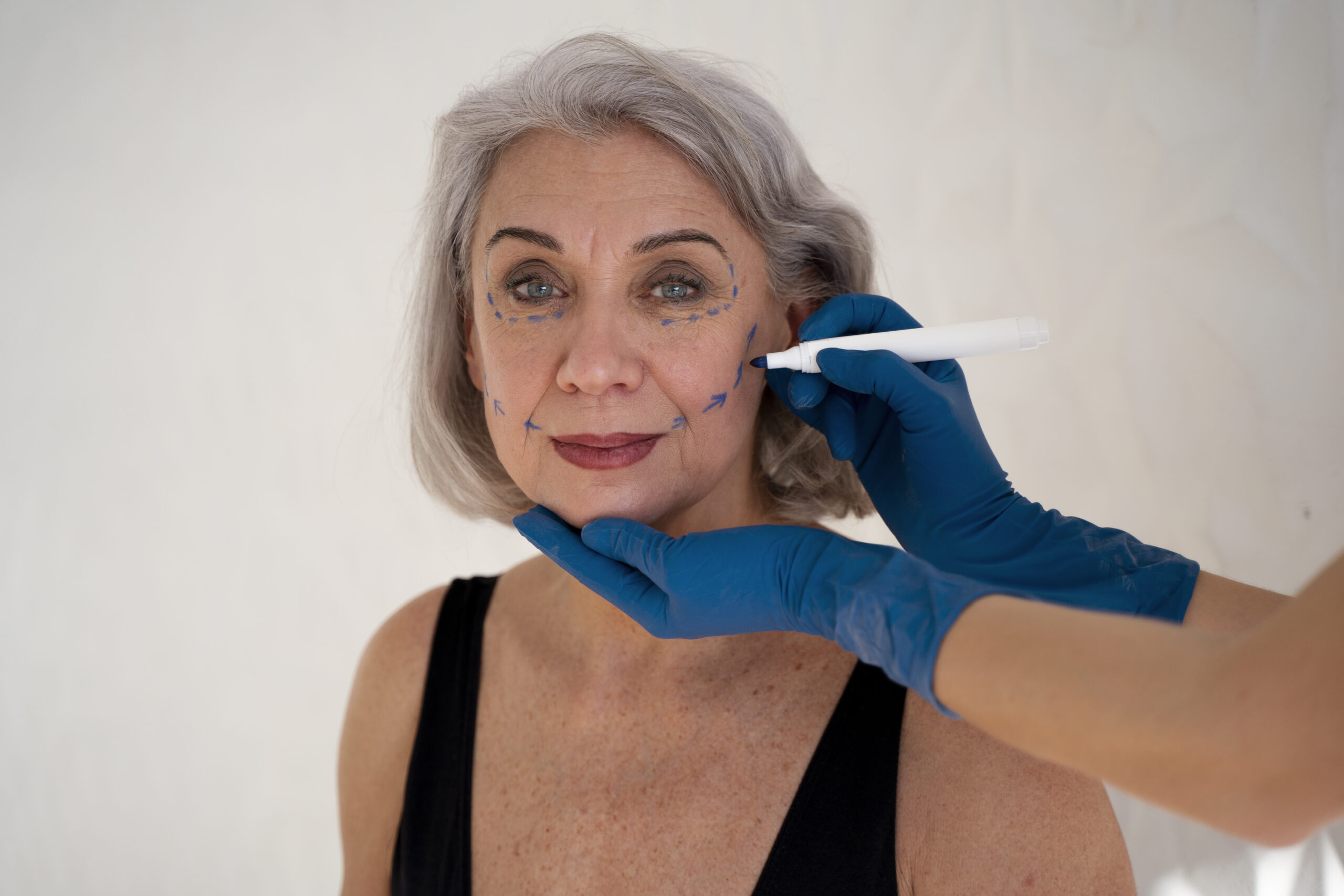 Quanto Custa um Facelifting em Curitiba?