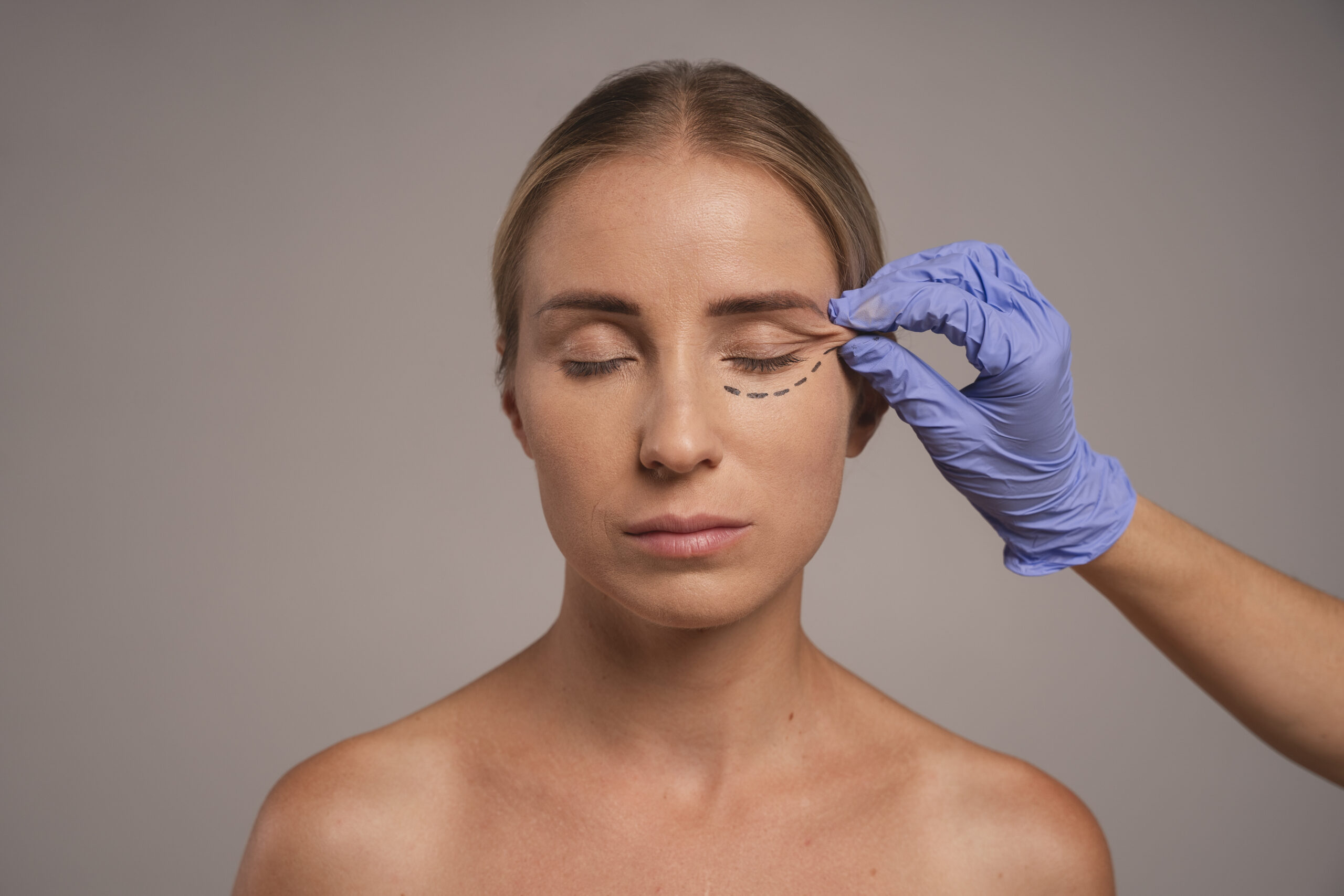 Blefaroplastia: Como a Cirurgia das Pálpebras REJUVENESCE o Olhar.