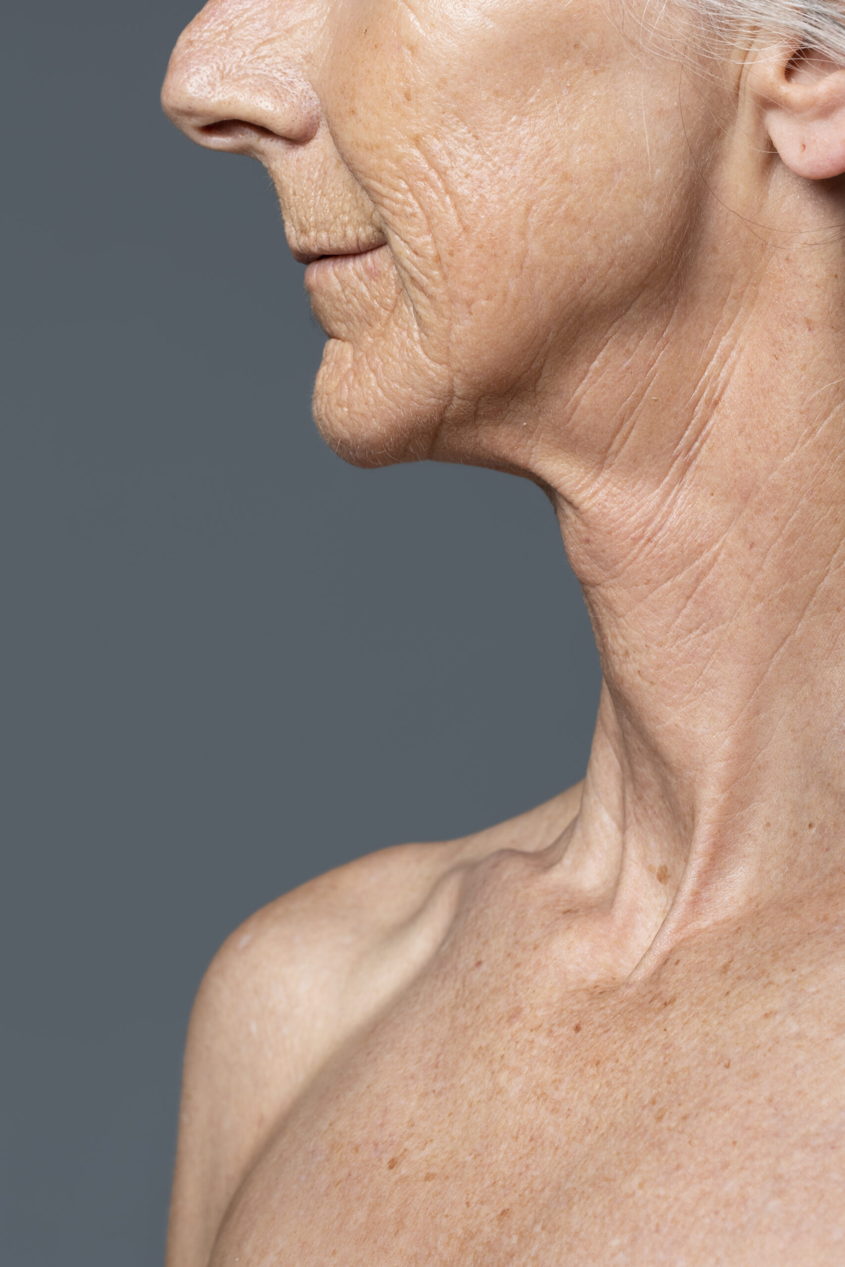 Deep Neck Facelift: Como Esta Cirurgia Rejuvenesce Pescoço e Trás uma Aparência Jovial?